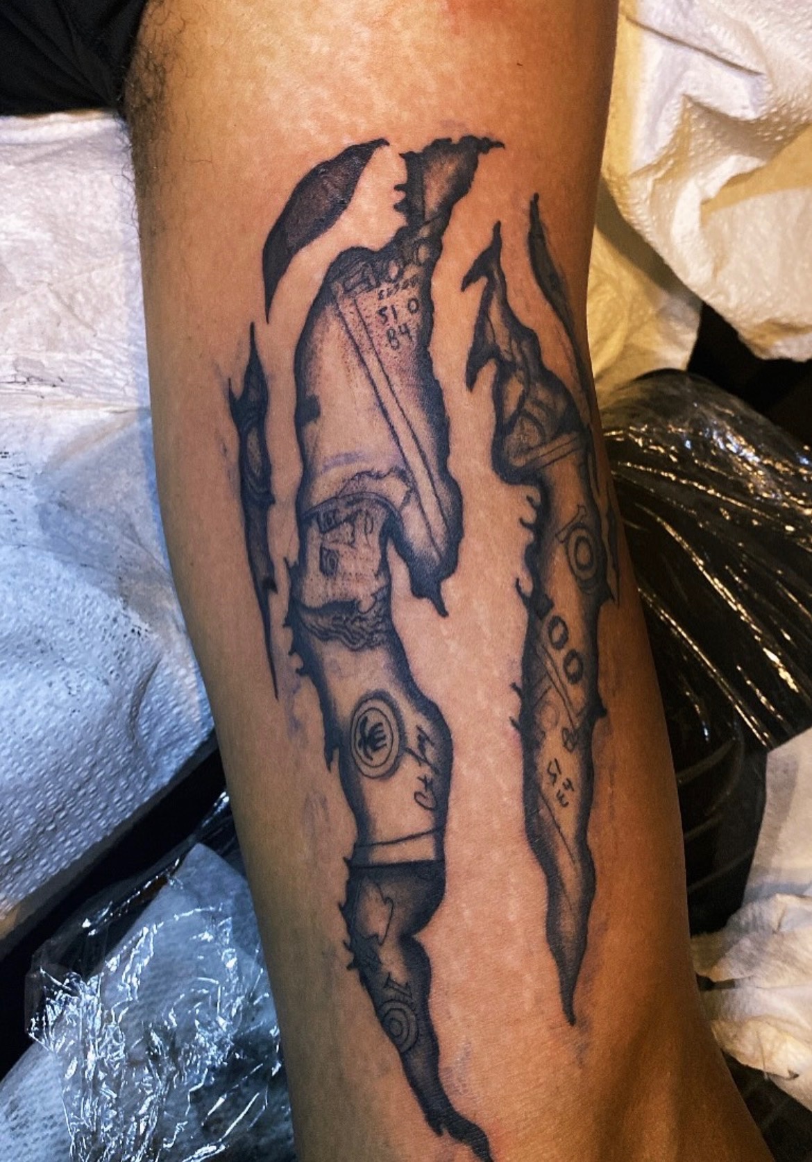 Skin Rip — Forearm